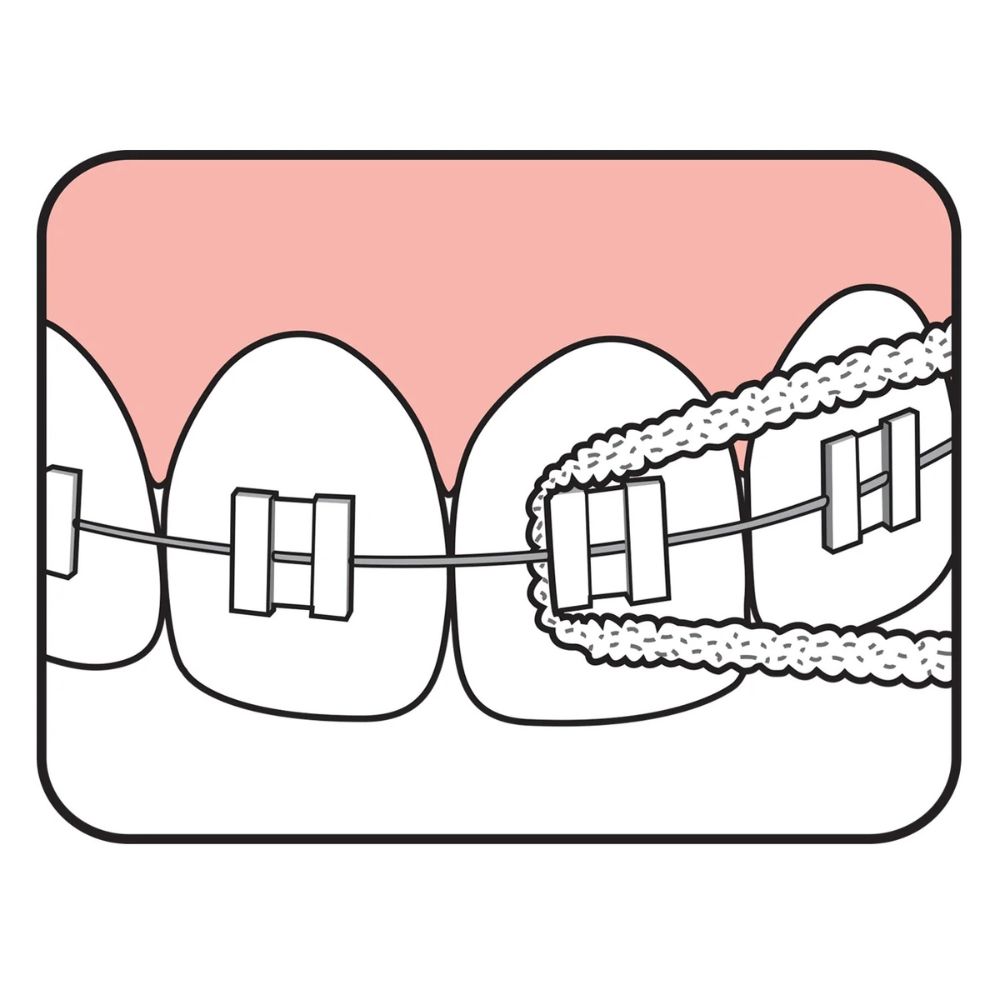 TePe Bridge & Implant Dental Floss Pack Of 30