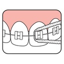 TePe Bridge & Implant Dental Floss Pack Of 30