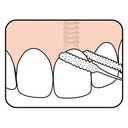 TePe Bridge & Implant Dental Floss Pack Of 30