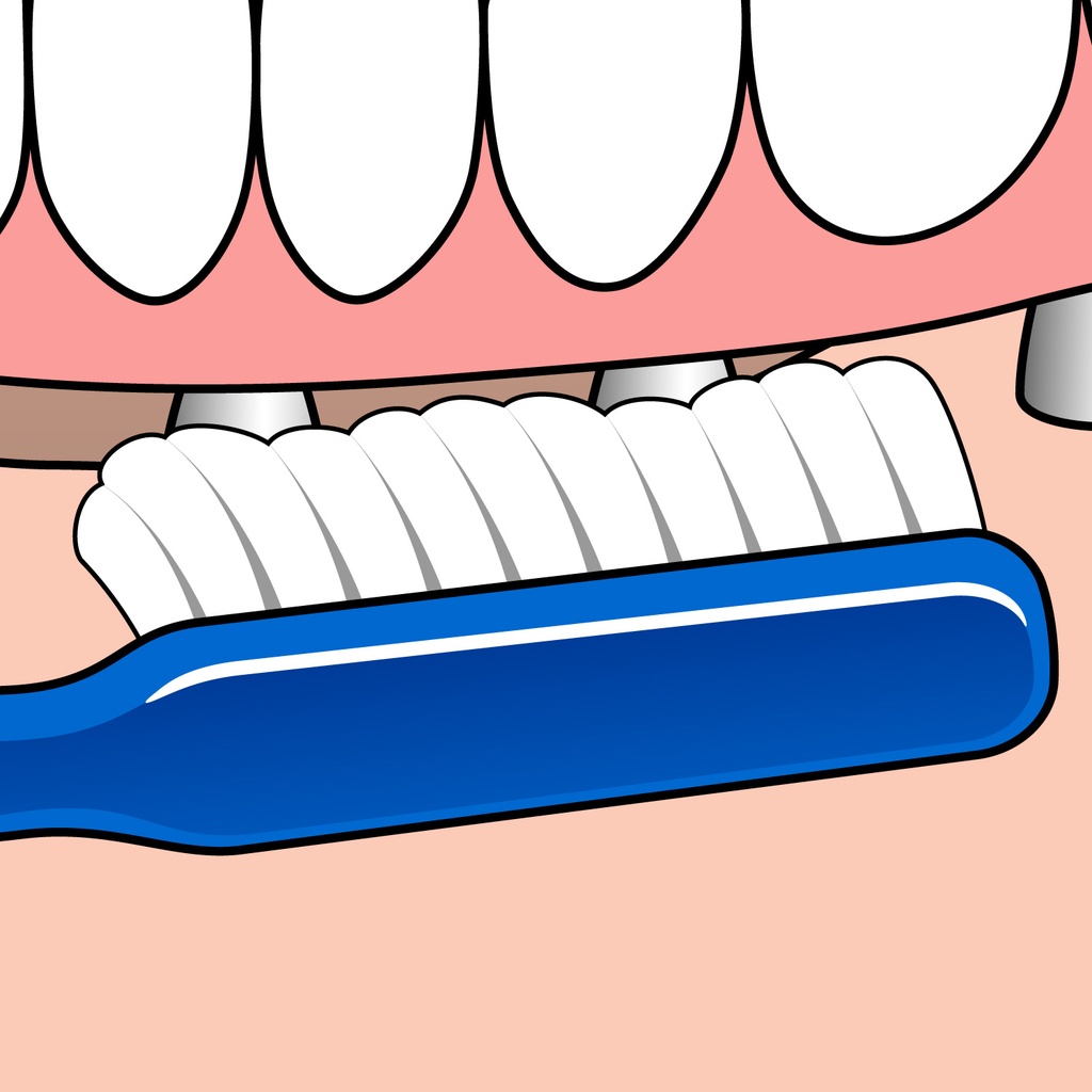 TePe Implant Orthodontic Toothbrush