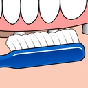 TePe Implant Orthodontic Toothbrush