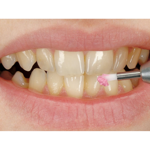 Hager & Werken Mira-Clin Prophy Paste 2g Jar Of 200