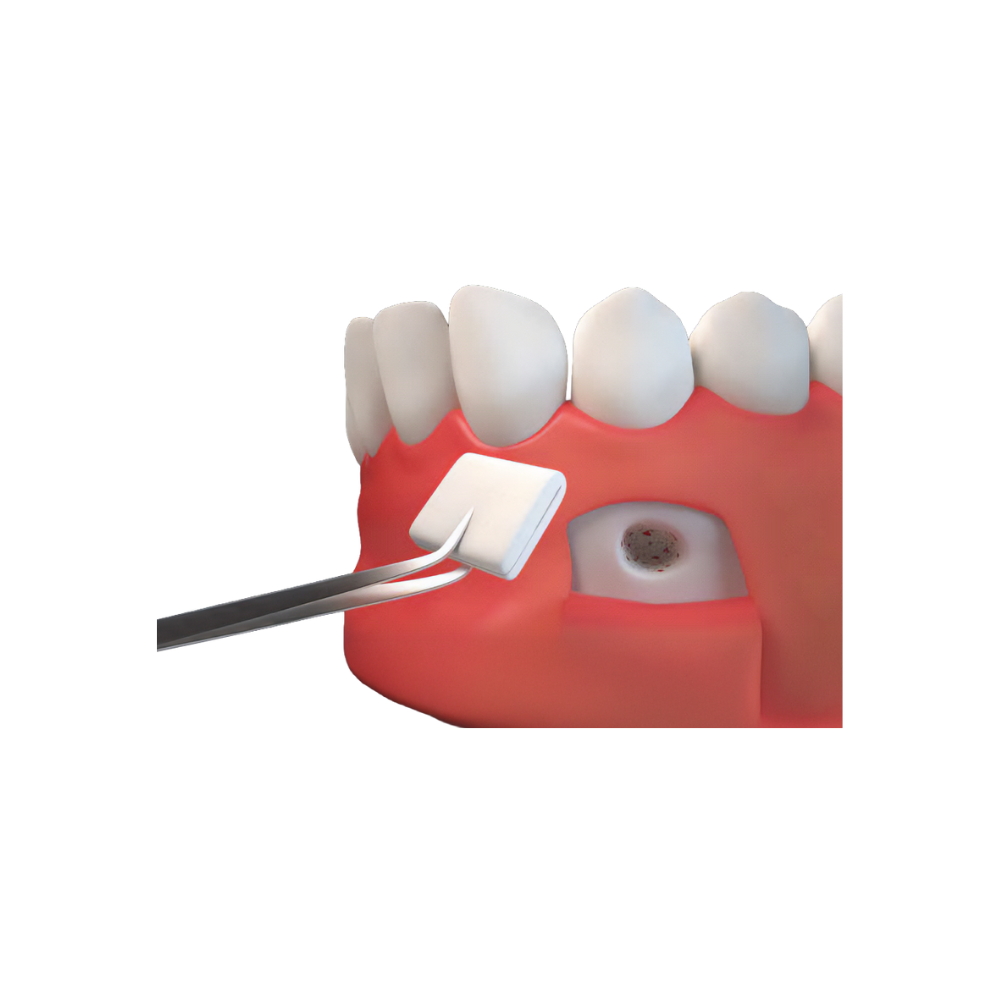 Resorba Parasorb Fleece HD 70x30mm Box Of 5