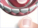Hager & Werken MiraFloss Tape